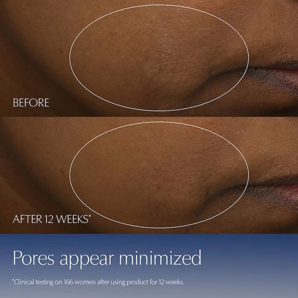 Estée Lauder Advanced Night Repair Recovery Complex Large-1.7 oz, all skin types - Picture 9 of 10